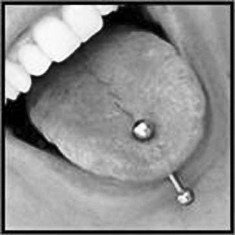 Oral piercing: It may be harmful to your health