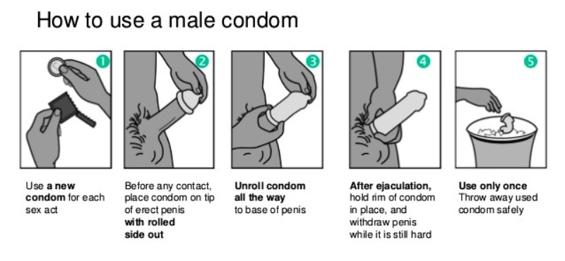 Como ponerse el condón correctamente
