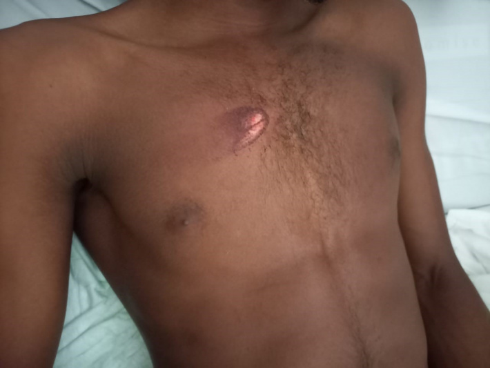 Teenager injured in police raid