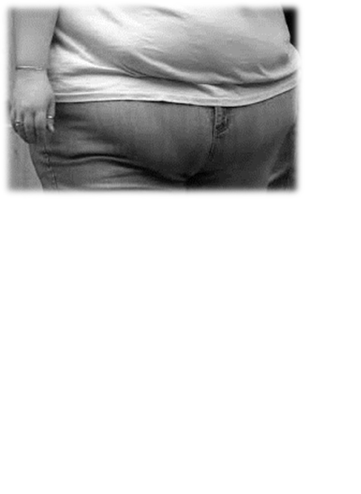Obesity is everyone’s business